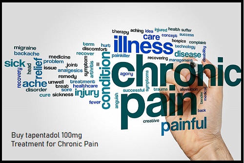 Chaonic Pain Treatment